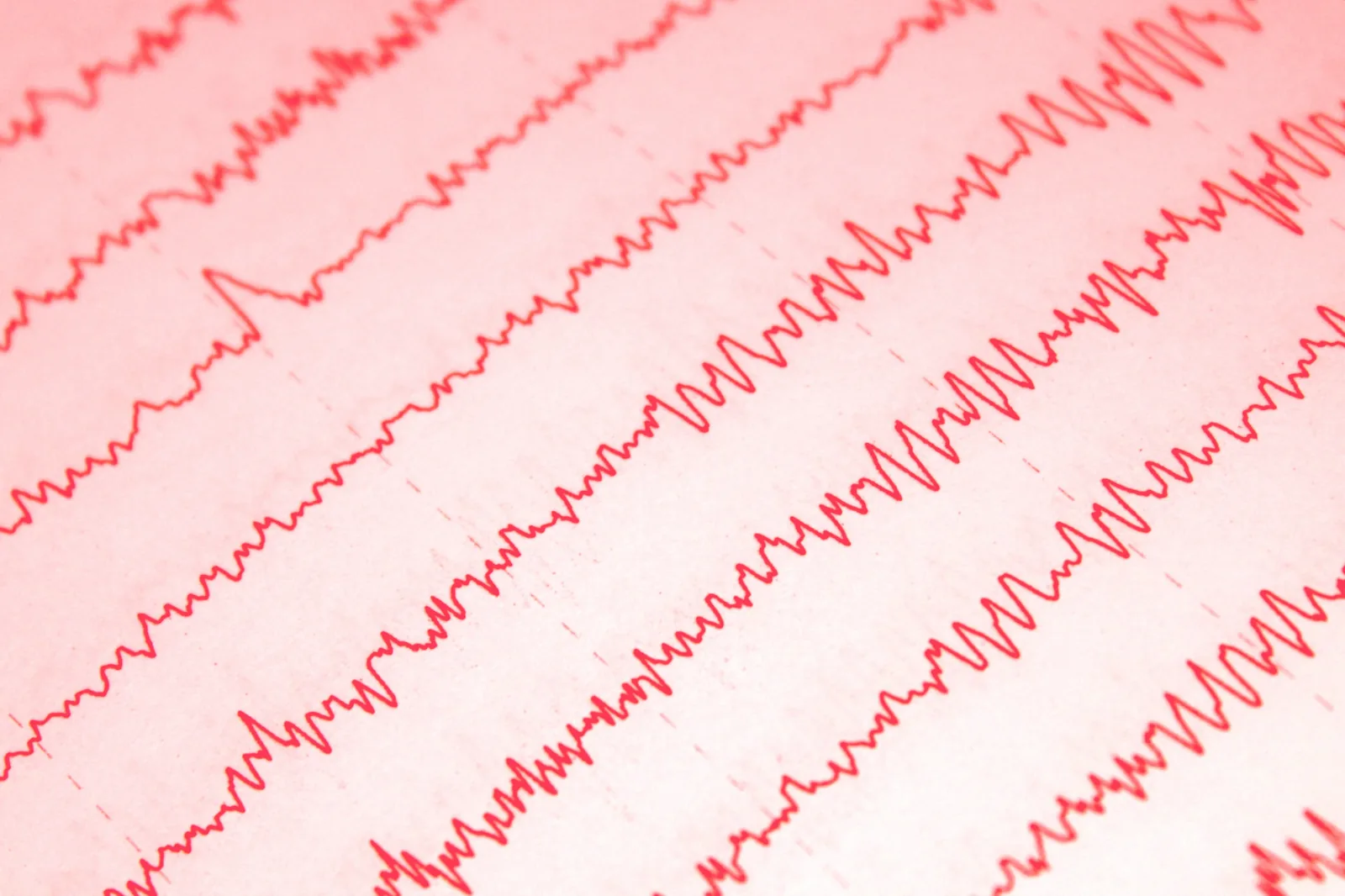 Red EEG traces on paper, the raw recordings sleep science is built on